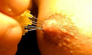 little needles pulling out from nipple